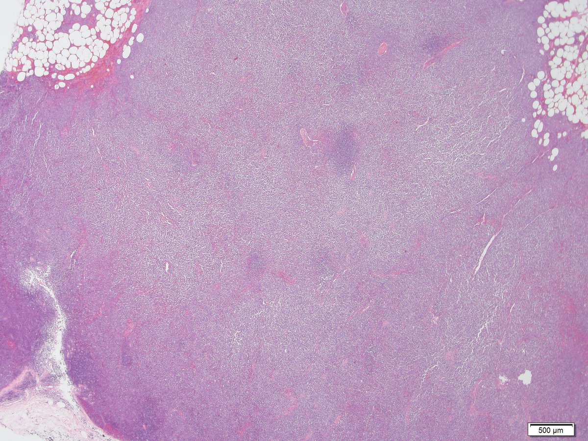 Figure 9 LN 2x